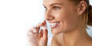 Clear Aligners - Image 6