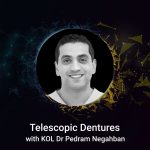 Telescopic Dentures