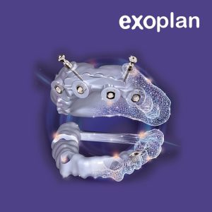 exoplan-for-the-guide-creator-exocad