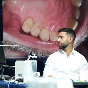 posterior-dentistry-simplifying-dr-hassan-asad