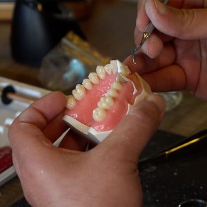 Composite Veneers Masterclass - Image 6