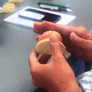 Mastering Copy Dentures with Trios - Image 6