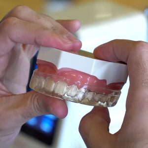 Veneers Course