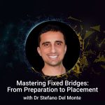 Mastering Fixed Bridges: From Preparation to Placement